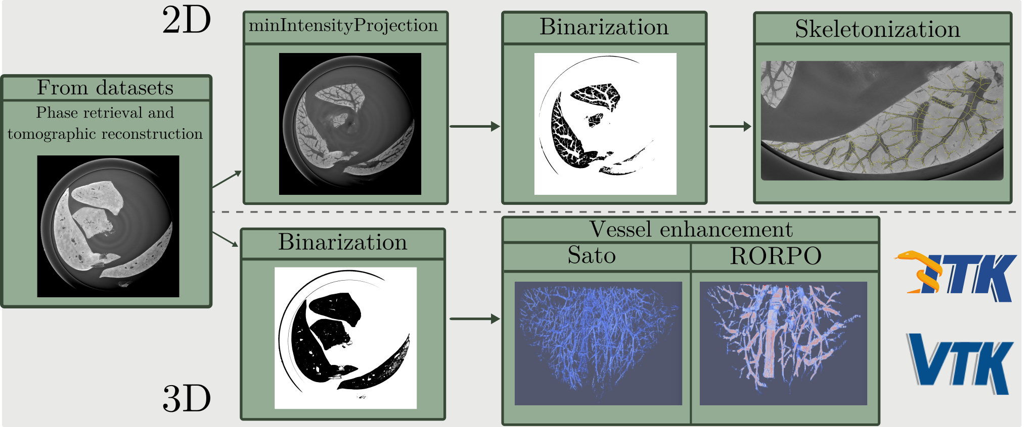 extraction pipeline of vascular network.